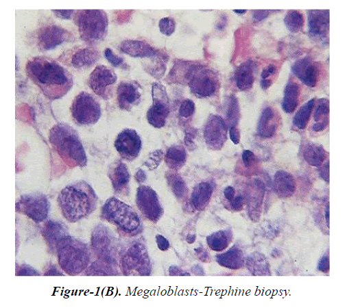 general-internal-medicine-Trephine-biopsy