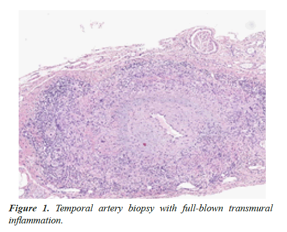 general-internal-medicine-artery-biopsy