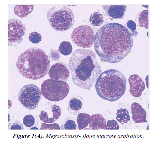 general-internal-medicine-marrow-aspiration