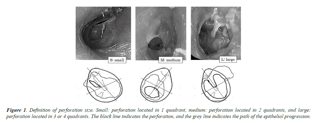 general-internal-medicine-perforation-size