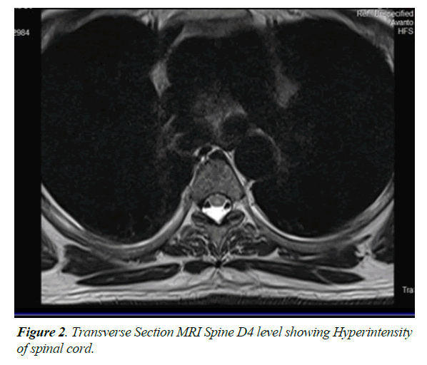 general-internal-medicine-spinal-cord