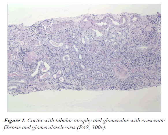 general-internal-medicine-tubular-atrophy