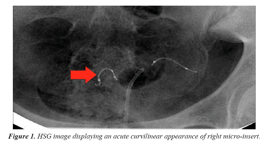 gynecology-obstetrics-acute-curvilinear