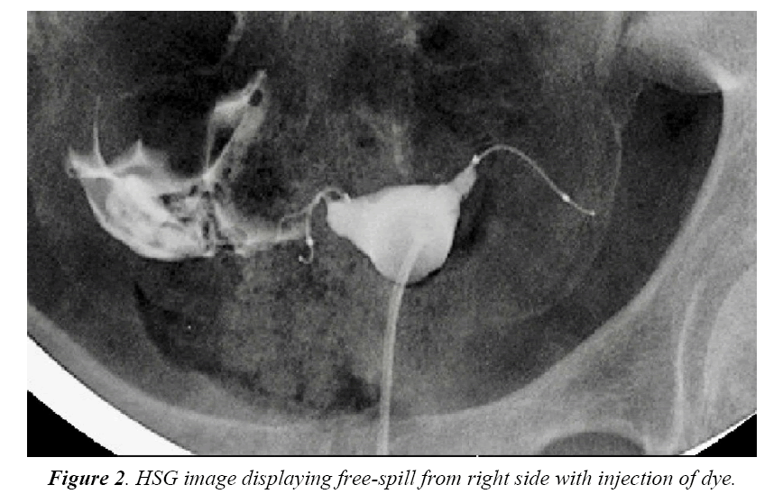 gynecology-obstetrics-displaying-free-spill