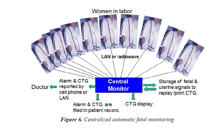 gynecology-obstetrics-hysteroscopic-centralized