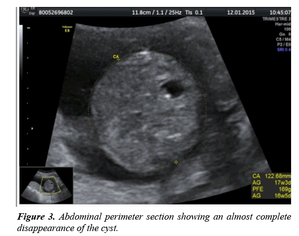 gynecology-obstetrics-hysteroscopic-disappearance