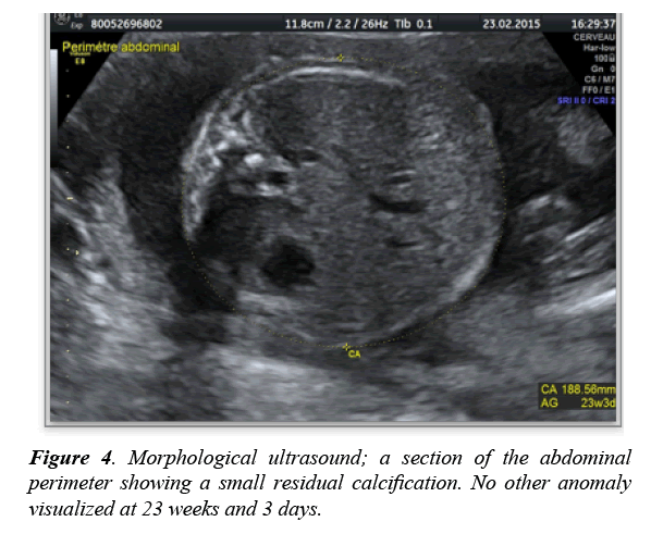 gynecology-obstetrics-hysteroscopic-morphological