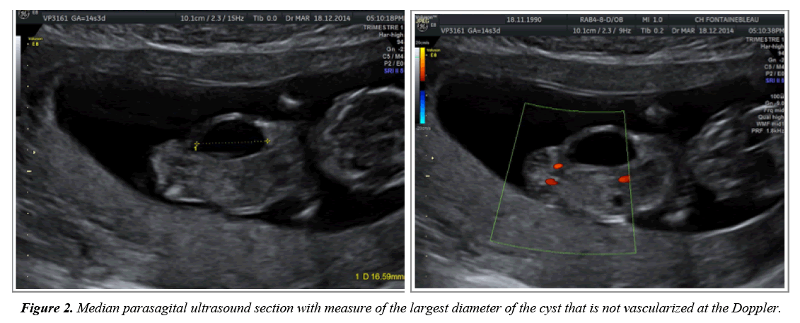 gynecology-obstetrics-hysteroscopic-vascularized