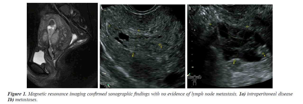 gynecology-obstetrics-sonographic-findings