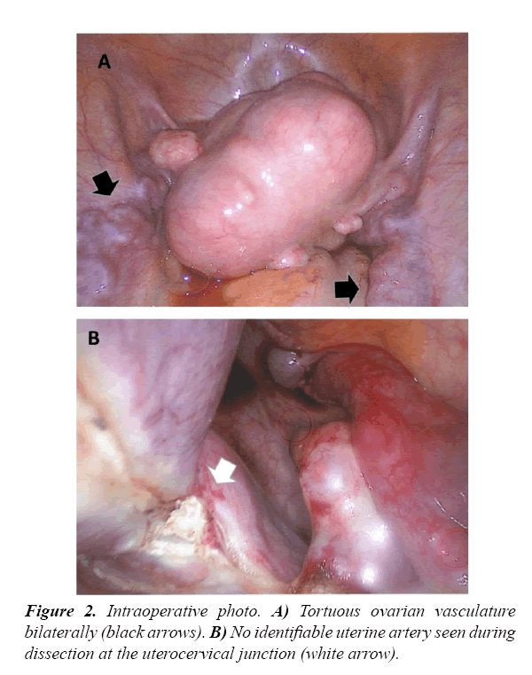 gynecology-obstetrics-tortuous-ovarian-vasculature