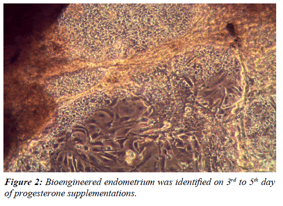 gynecology-reproductive-endocrinology-Bioengineered-endometrium