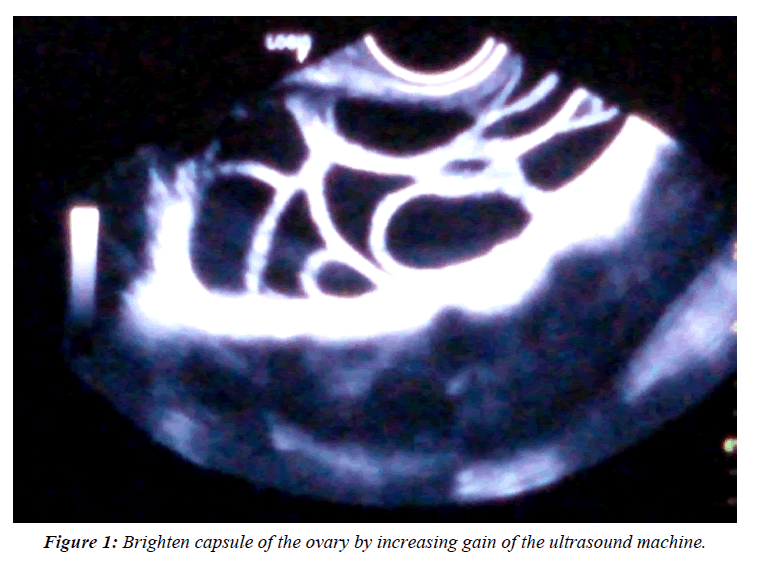 gynecology-reproductive-endocrinology-Brighten-capsule