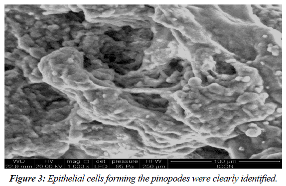 gynecology-reproductive-endocrinology-Epithelial-cells