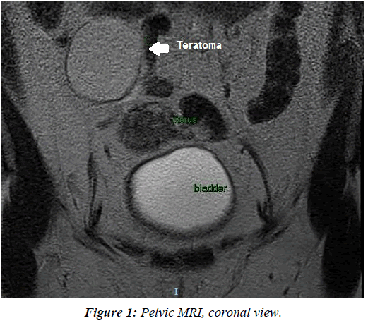 gynecology-reproductive-endocrinology-Pelvic-MRI