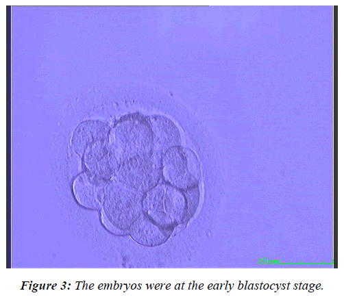 gynecology-reproductive-endocrinology-blastocyst-stage