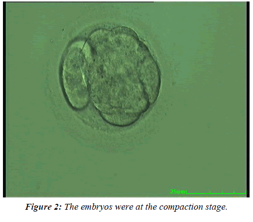 gynecology-reproductive-endocrinology-compaction-stage