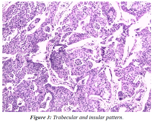 gynecology-reproductive-endocrinology-insular-pattern