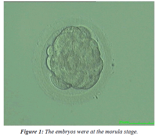 gynecology-reproductive-endocrinology-morula-stage