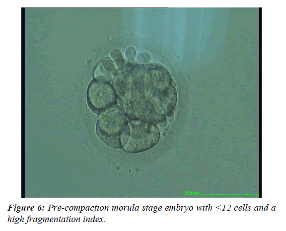 gynecology-reproductive-endocrinology-morula-stage