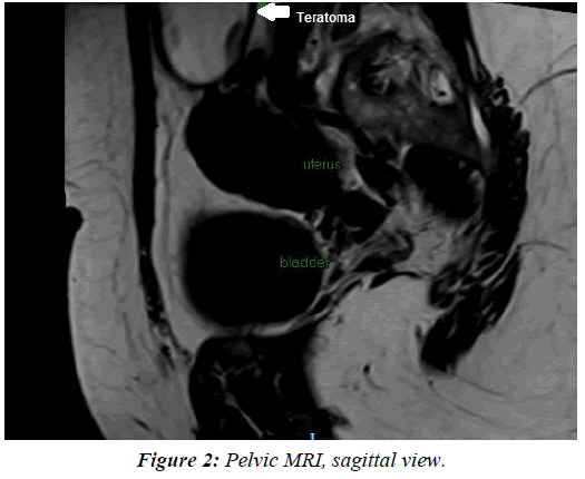 gynecology-reproductive-endocrinology-sagittal-view