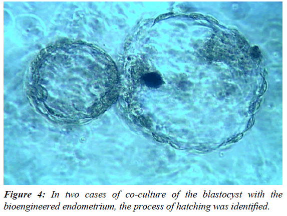 gynecology-reproductive-endocrinology-two-cases