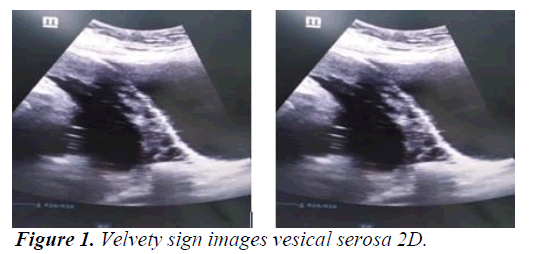 gynecology-vesical