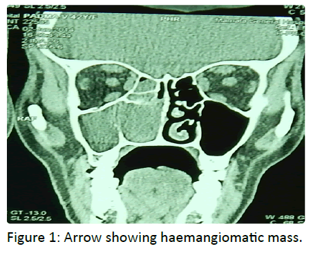 haemangiomatic