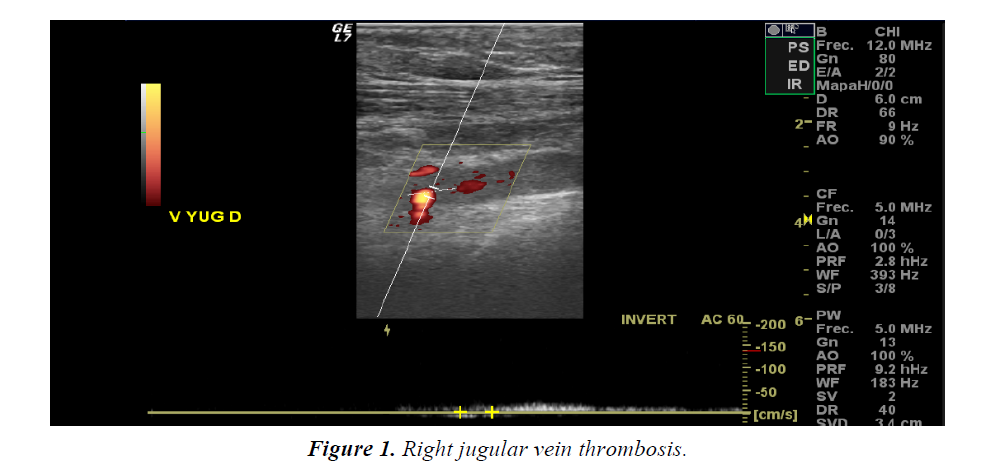 histology-cell-biology-jugular-vein-thrombosis