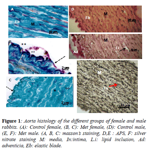 insights-nutrition-metabolism-Aorta-histology