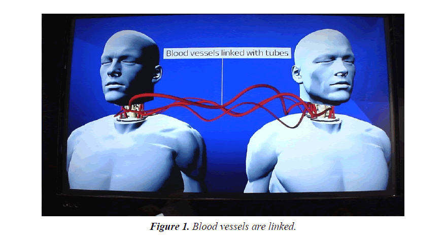 integrative-neuroscience-research-blood-vessels