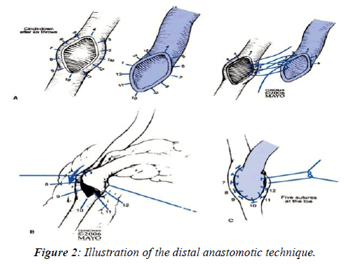 invasive-non-invasive-cardiology-anastomotic