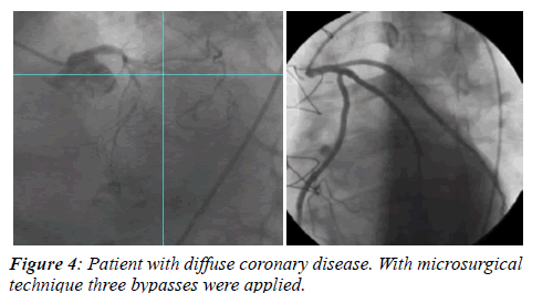 invasive-non-invasive-cardiology-coronary