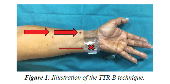 invasive-non-invasive-cardiology-illustration