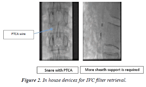 invasive-non-invasive-cardiology-retrieval