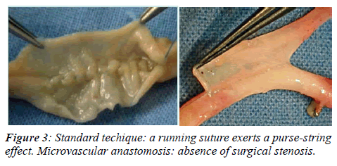 invasive-non-invasive-cardiology-stenosis