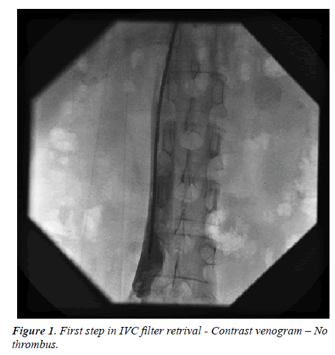 invasive-non-invasive-cardiology-venogram