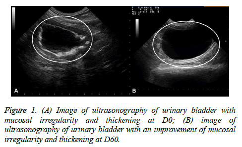 jbiopharm-bladder