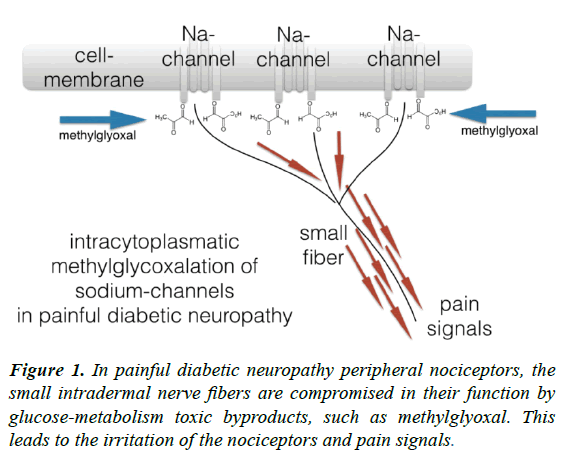 journal-diabetology-neuropathy-peripheral