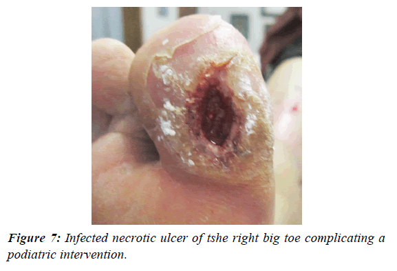 journal-diabetology-podiatric-intervention