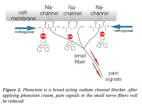 journal-diabetology-sodium-channel