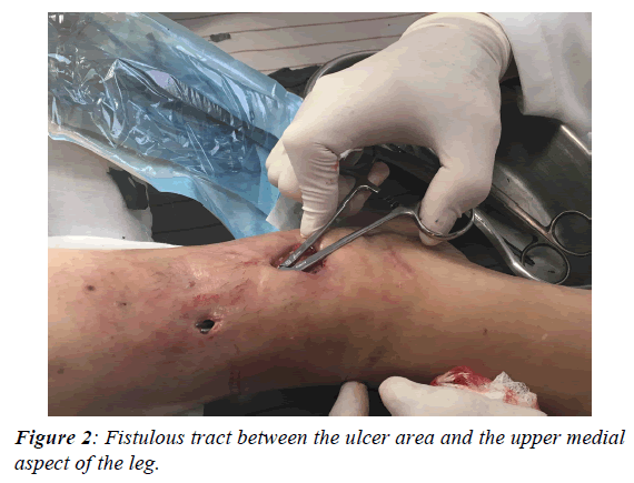 journal-diabetology-upper-medial