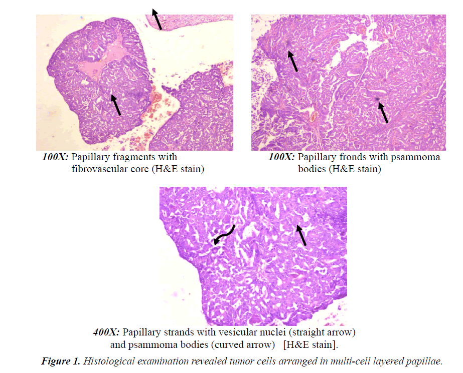 medical-oncology-therapeutics-Histological-examination