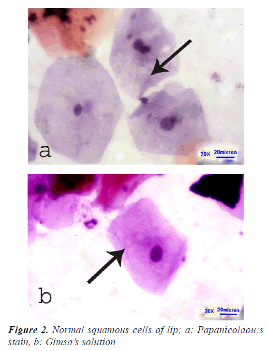 medical-oncology-therapeutics-Normal-squamous