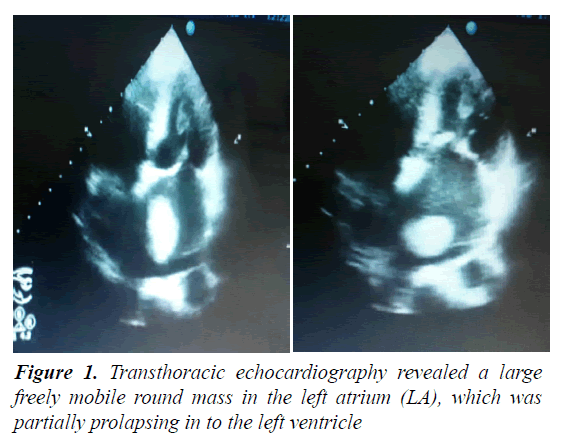 medical-oncology-therapeutics-Transthoracic-echocardiography