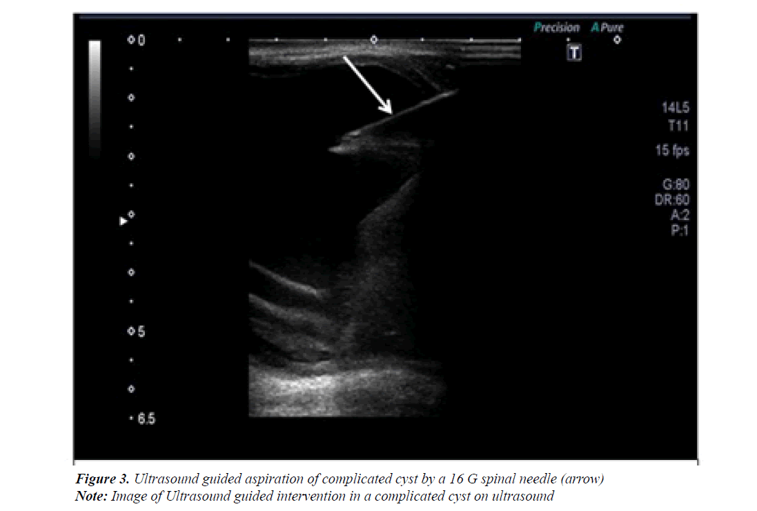 medical-oncology-therapeutics-Ultrasound-guided