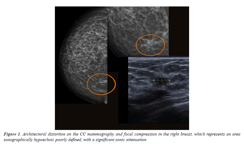 medical-oncology-therapeutics-hypoechoic-poorly