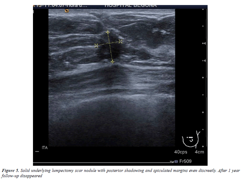 medical-oncology-therapeutics-lumpectomy-scar