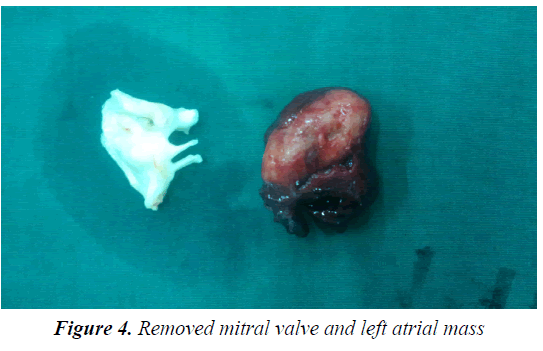 medical-oncology-therapeutics-mitral-valve