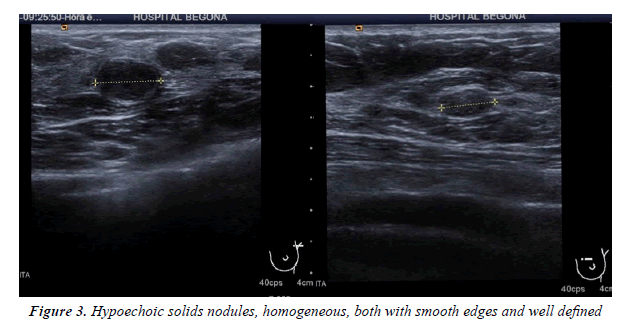 medical-oncology-therapeutics-solids-nodules