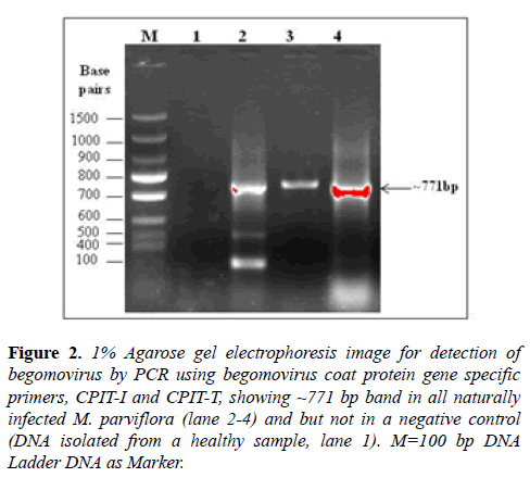 microbiology-Agarose-gel